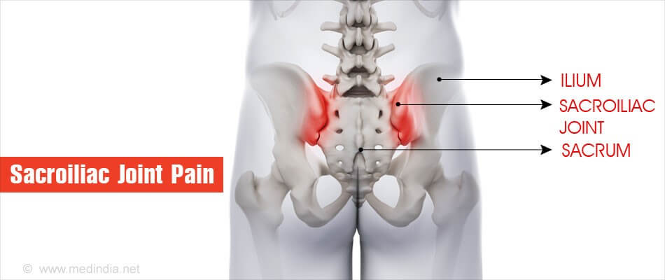 Sacroiliac Joint Pain Relief Tips